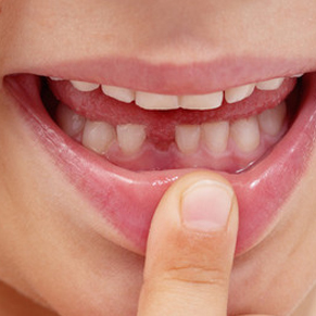 做牙齿隐形矫正很简单，找谁都一样？