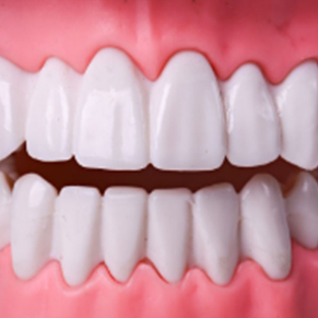 什么是牙齿隐形矫正
