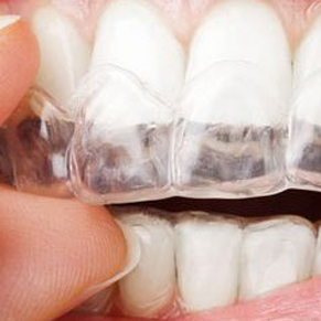 让种植牙品牌为您正解矫正牙齿四大误区