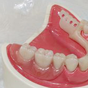 给孩子矫正牙齿的四大误区种植牙品牌告诉您