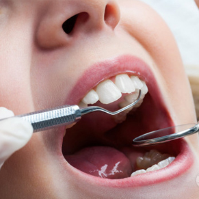 做牙科口腔的根管治疗要多长时间