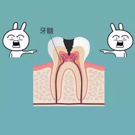 乳牙根管治疗