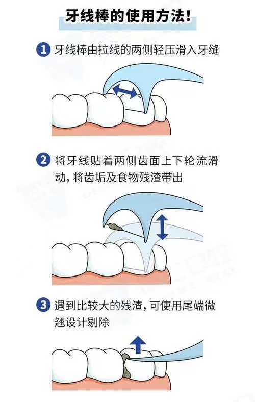 牙线.jpg