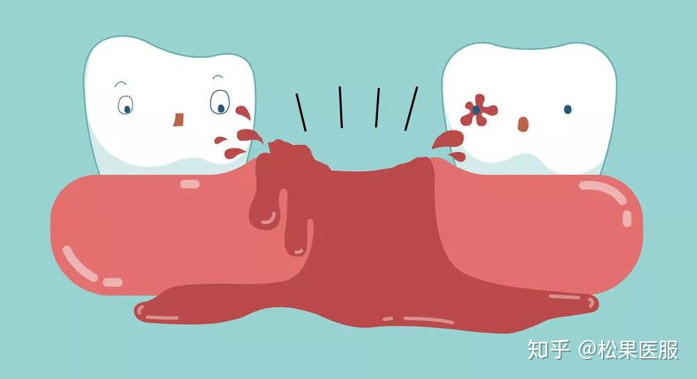 牙科干槽症是什么症状